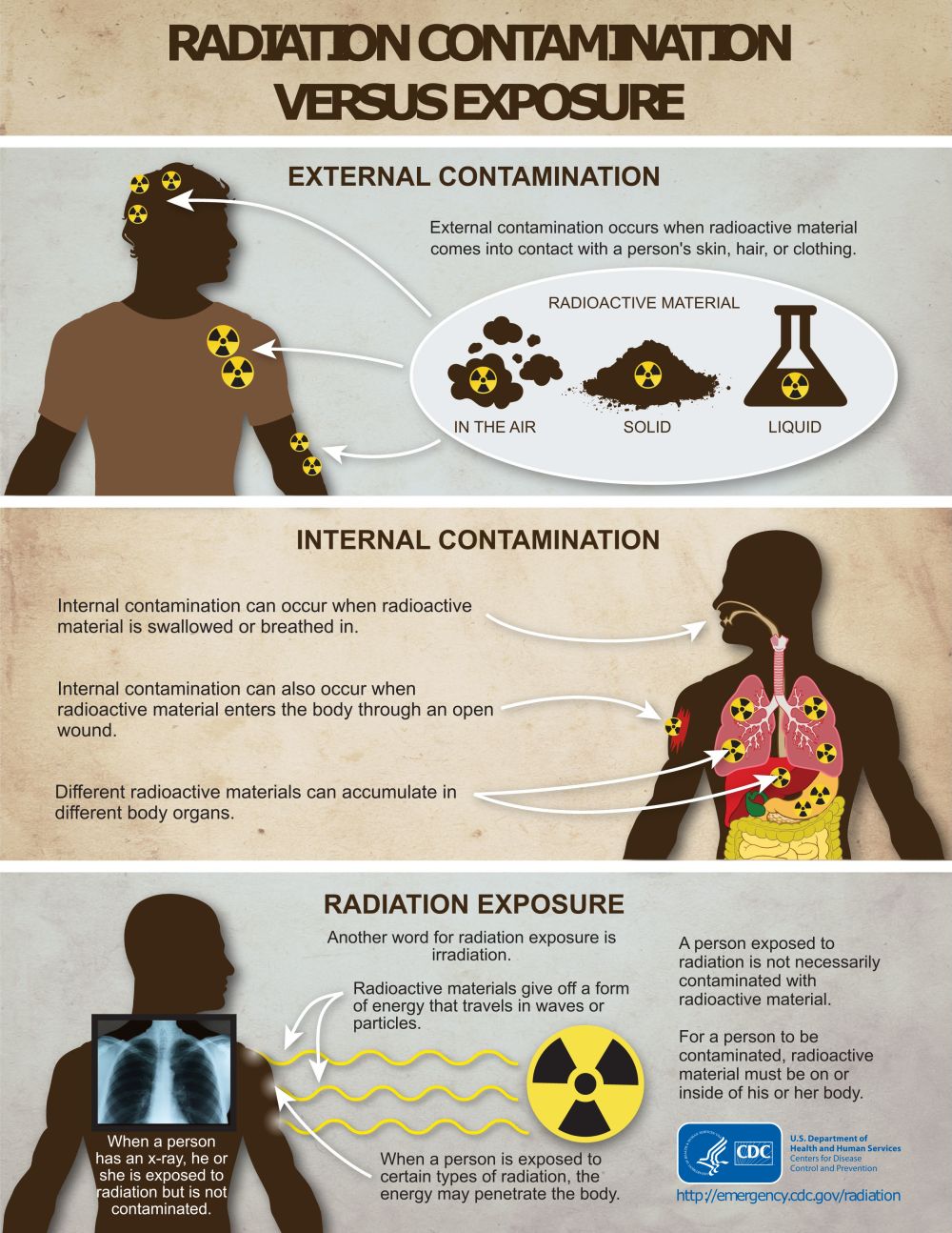 Radiation Contamination Versus Exposure